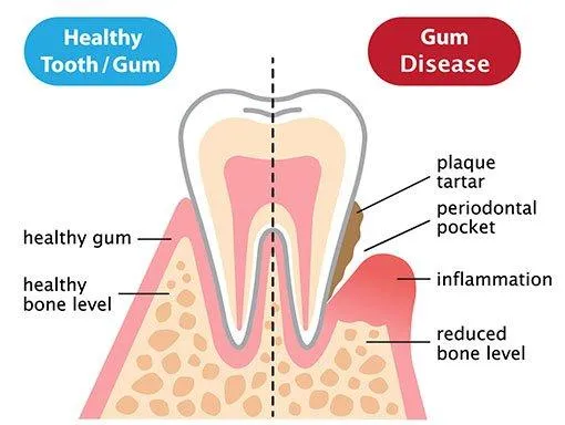 Surgical Interventions