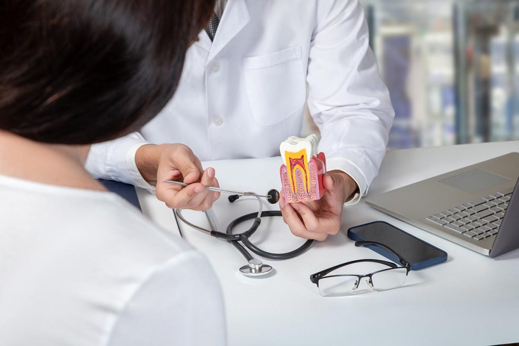 tooth sealing