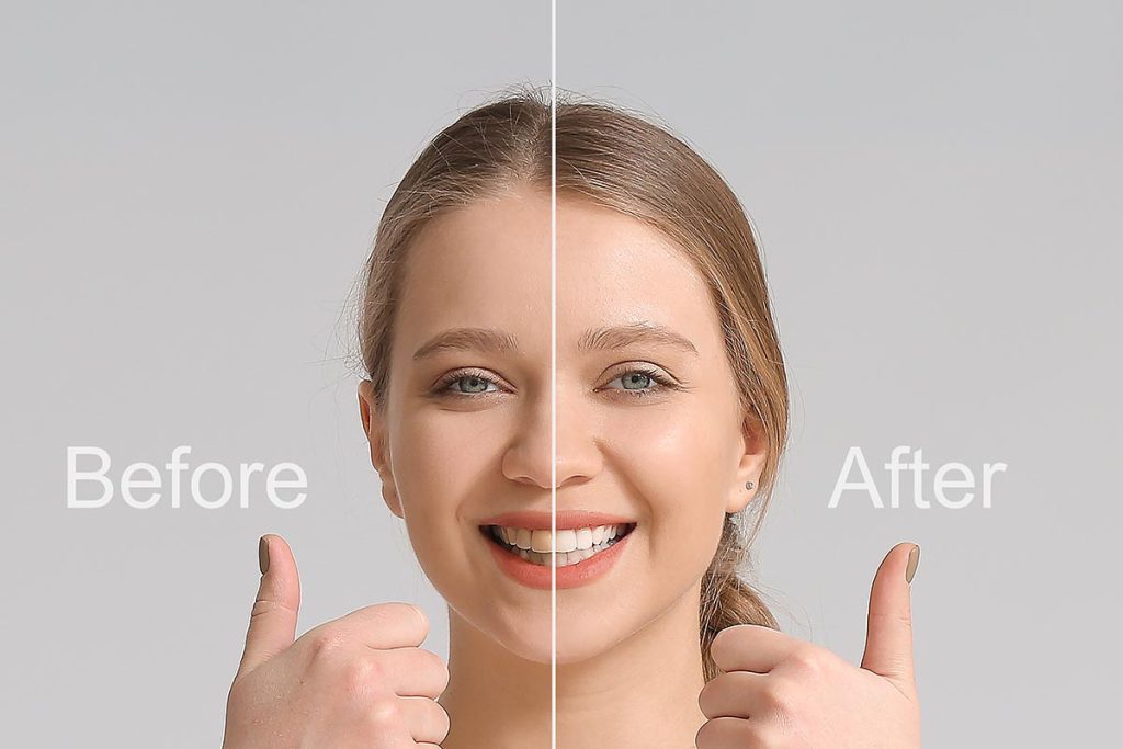 Gum Disease - snoring treatment