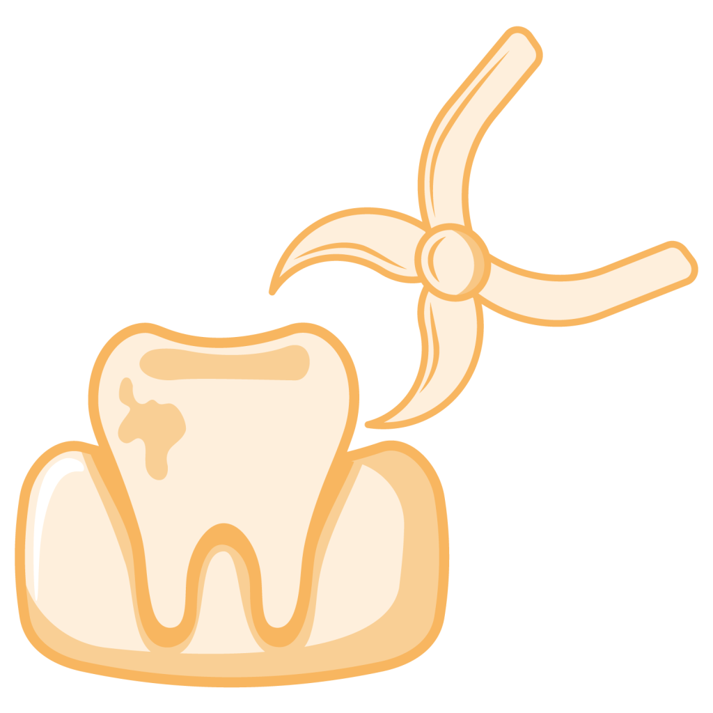 Tooth Extractions