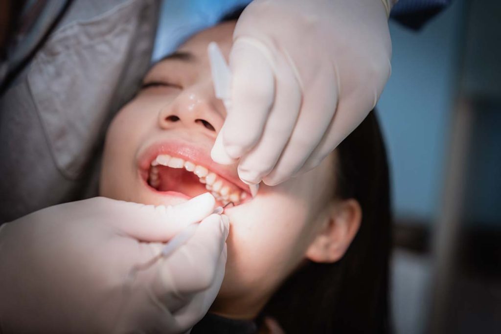 extracting teeth