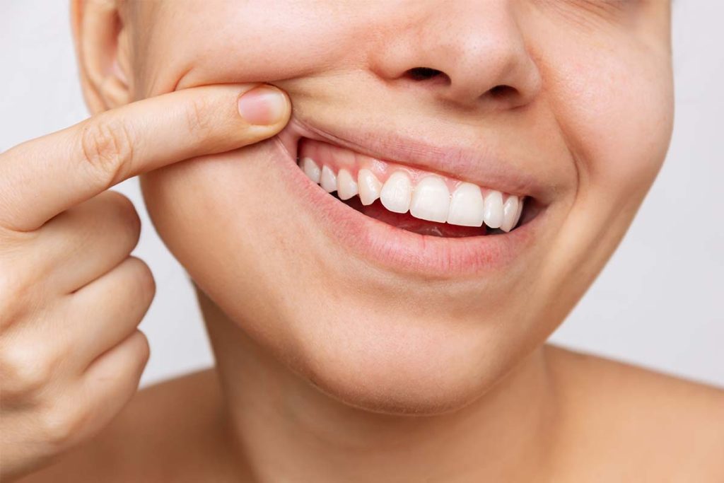 Teeth Whitening Vaughan