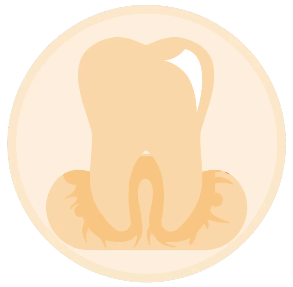 Gum Disease - TMJ