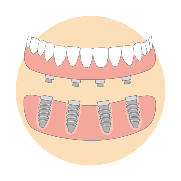 Mouth Reconstruction