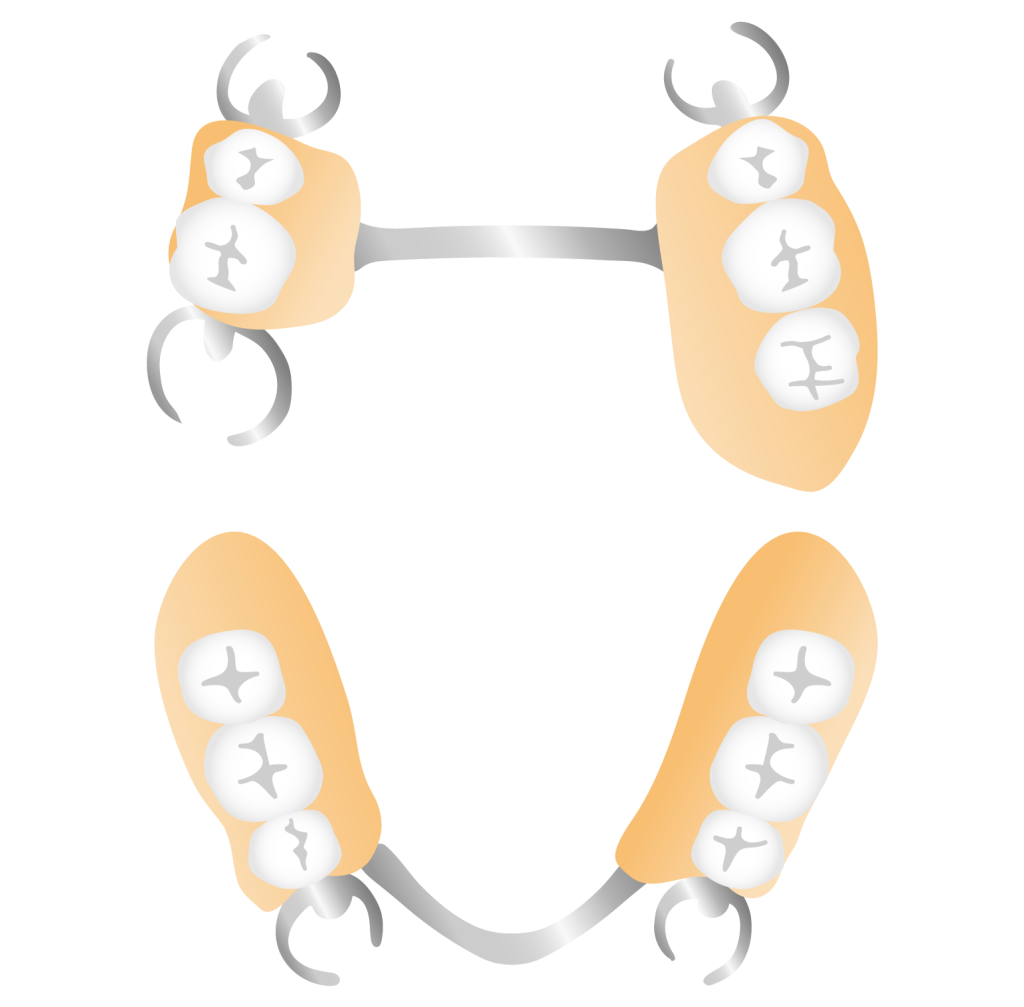 Partial Dentures