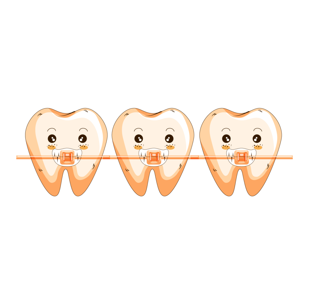 Dental Bonding