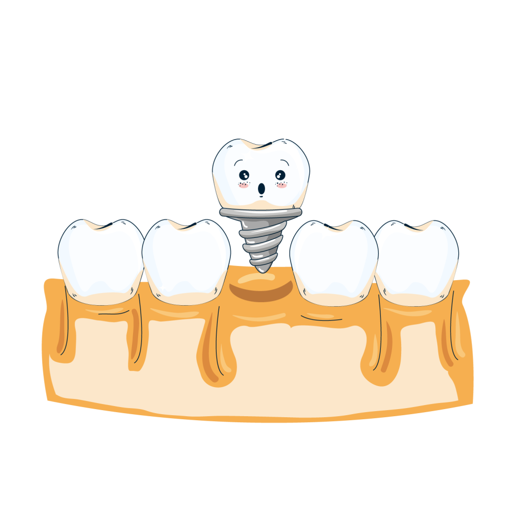 Dental Crowns