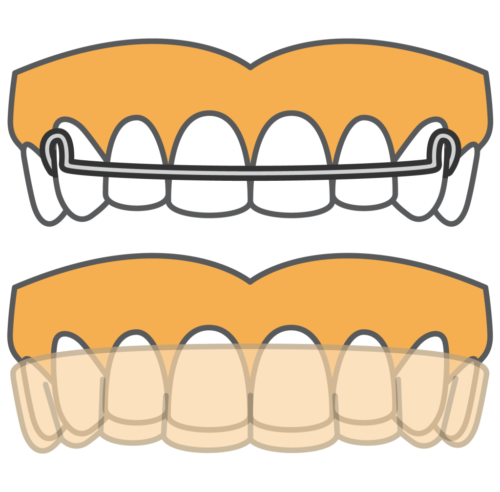 Clear Braces