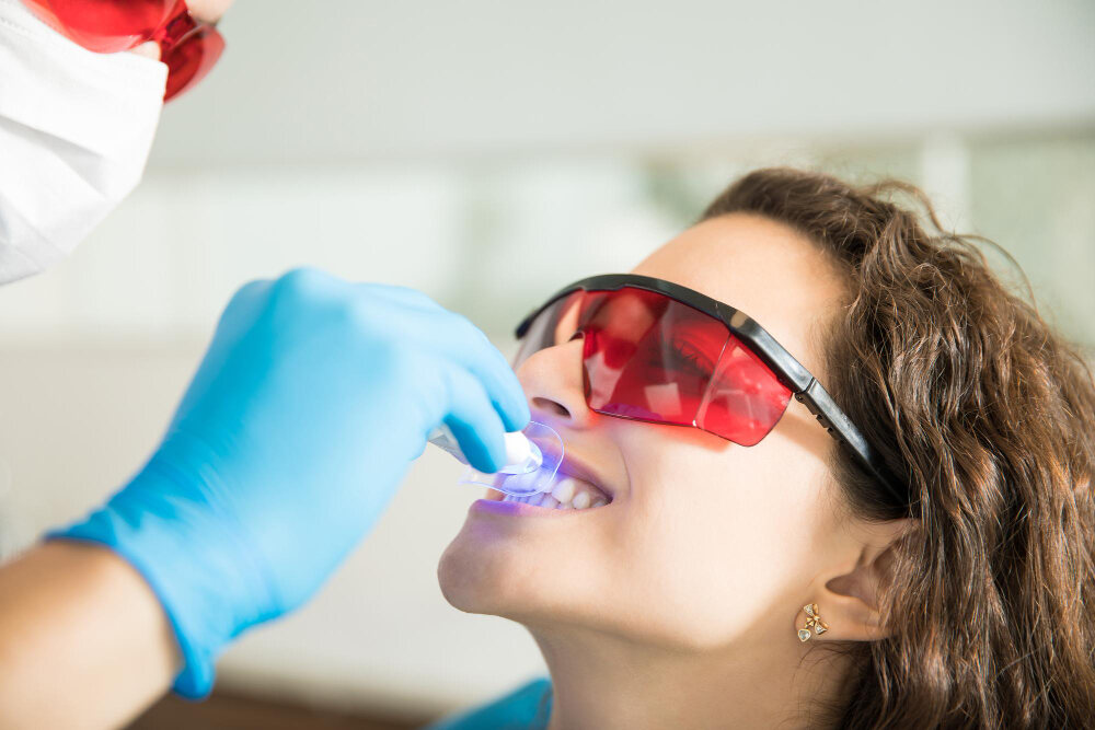 teeth whitening services
