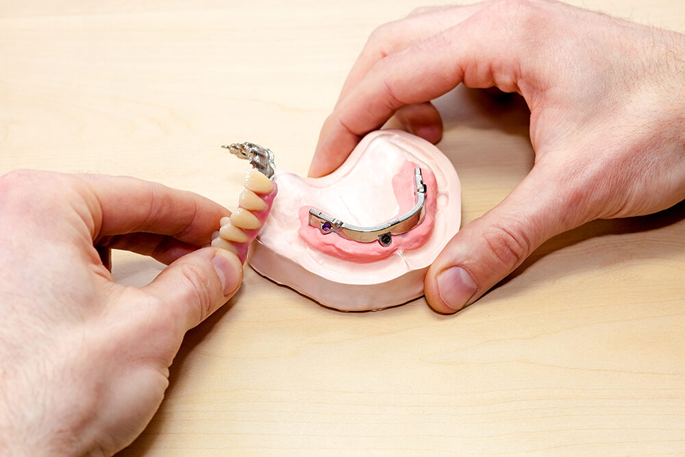 Full mouth reconstruction