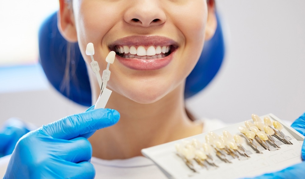 Teeth Whitening & At-Home Kits
