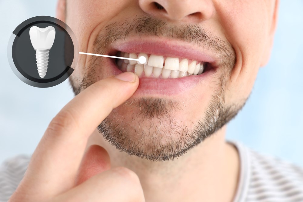 Online Dental Appointments