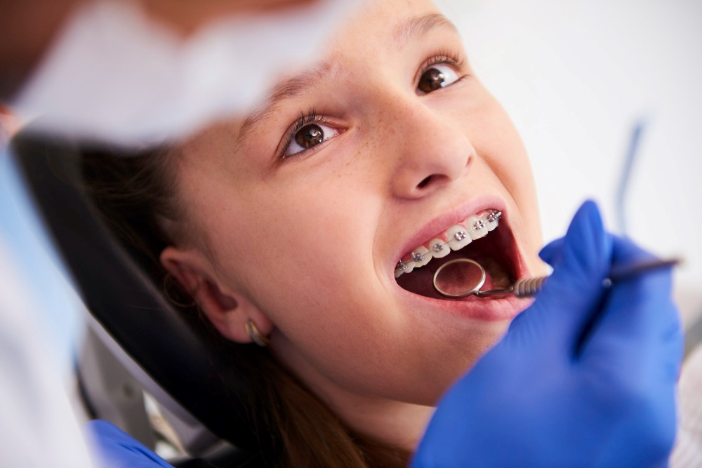 Orthodontist Treatment