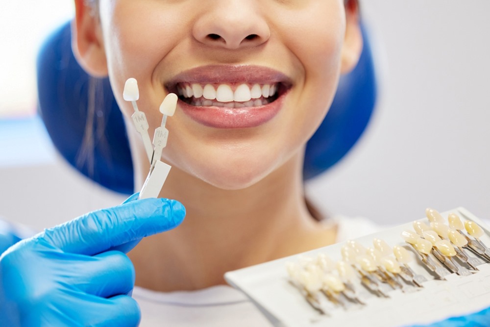 Dental Checkups