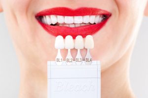 Porcelain Veneers in Vaughan