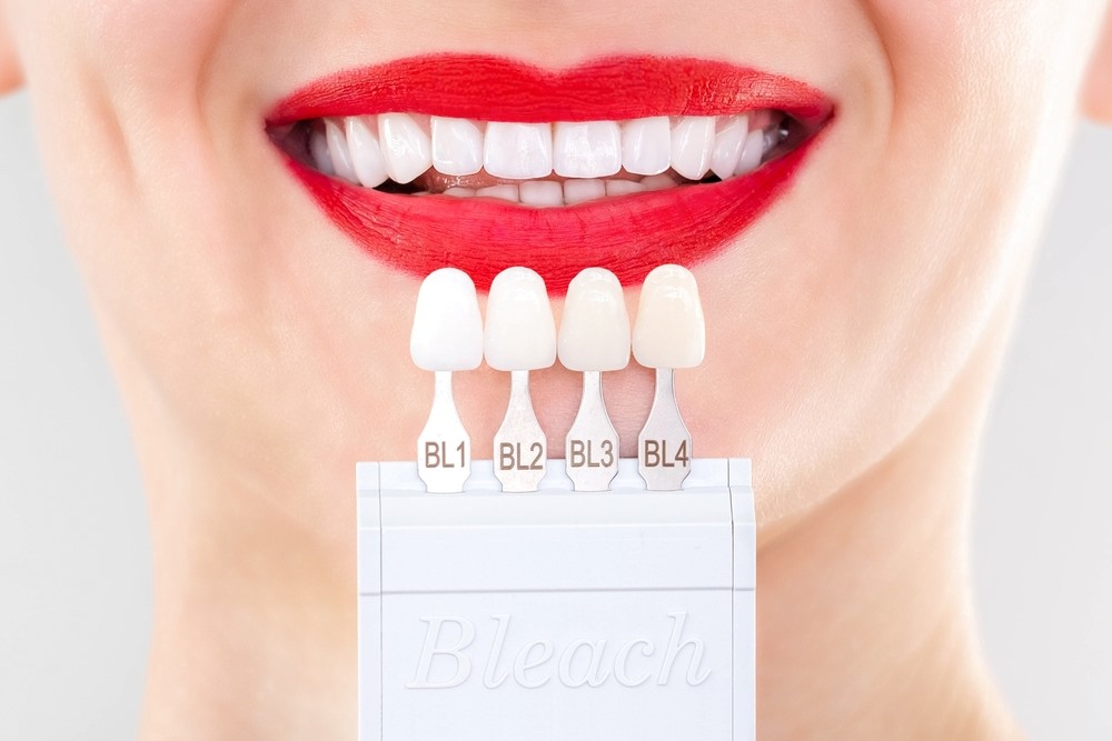 Porcelain Veneers in Vaughan