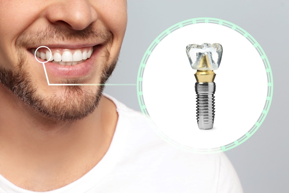 Restorative Dentistry