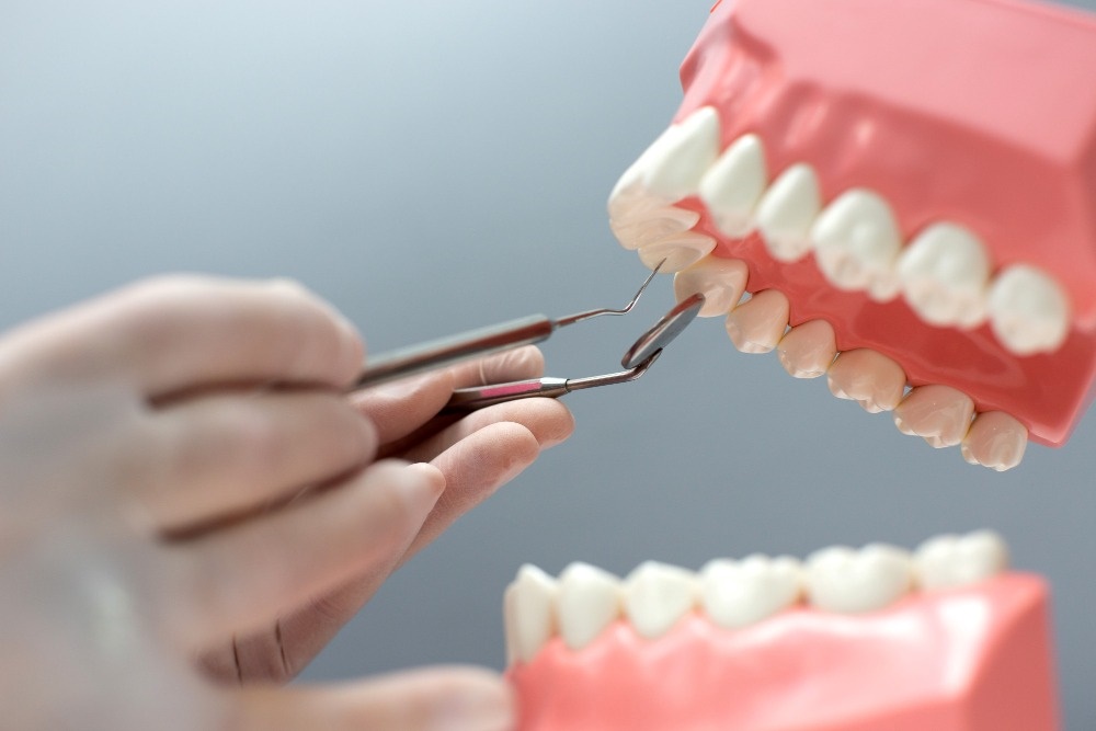 Tooth Implants Cost
